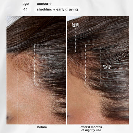 FutureIQ™ Biomimetic Hair Longevity Serum 90ml