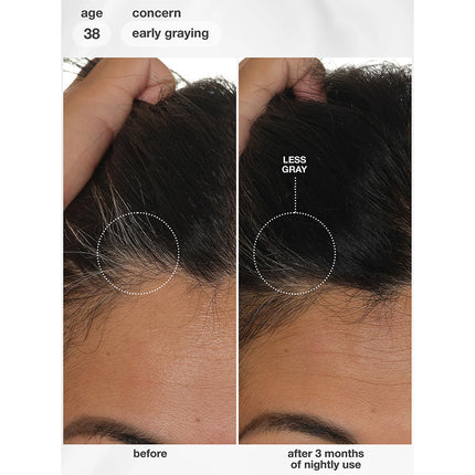 FutureIQ™ Biomimetic Hair Longevity Serum 90ml